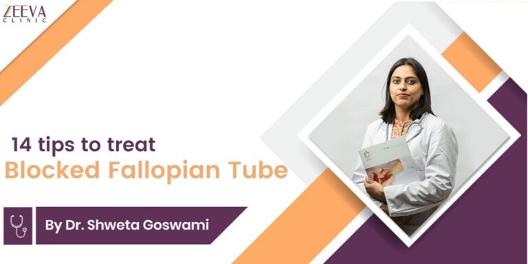 14 Tips To Treat Blocked Fallopian Tube