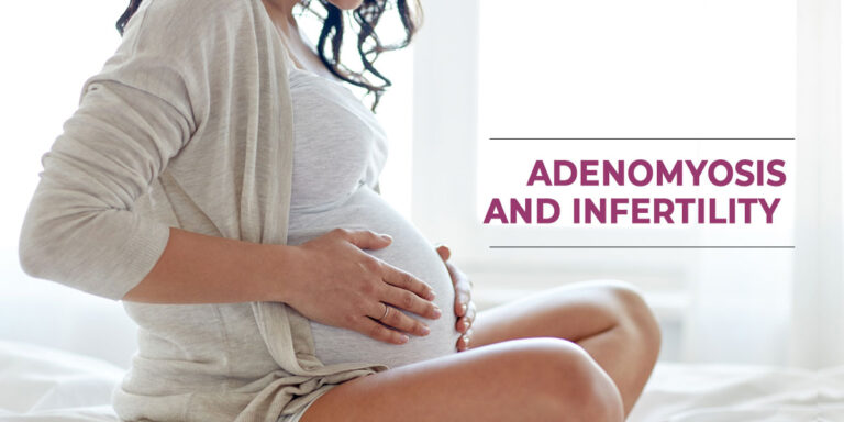 Adenomyosis and Infertility