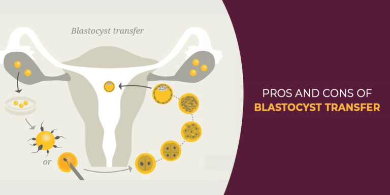 Pros and Cons of Blastocyst Transfer