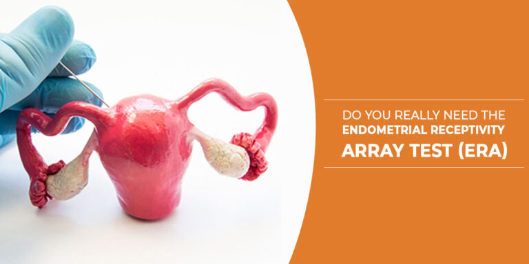 Do you really need the endometrial receptivity array test (ERA)