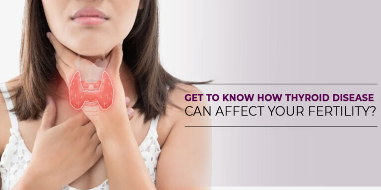 Get to know how thyroid disease can affect your fertility?