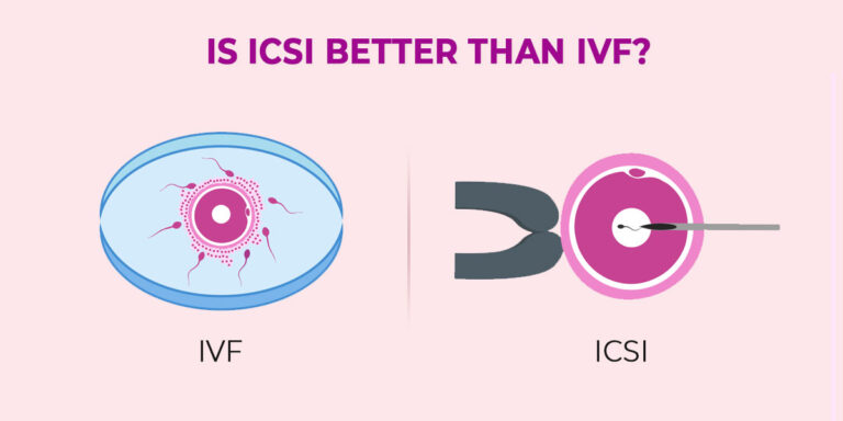 Is ICSI better than IVF?