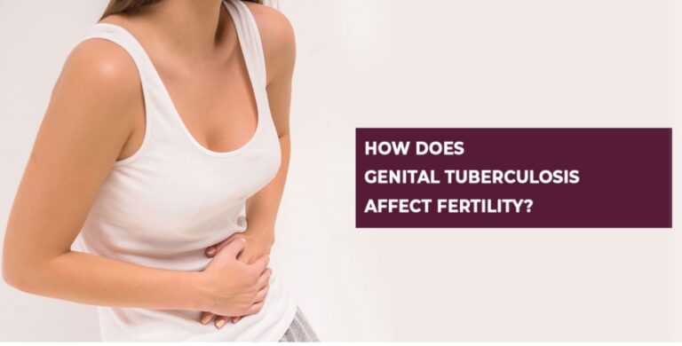 How does Genital Tuberculosis affect Fertility?