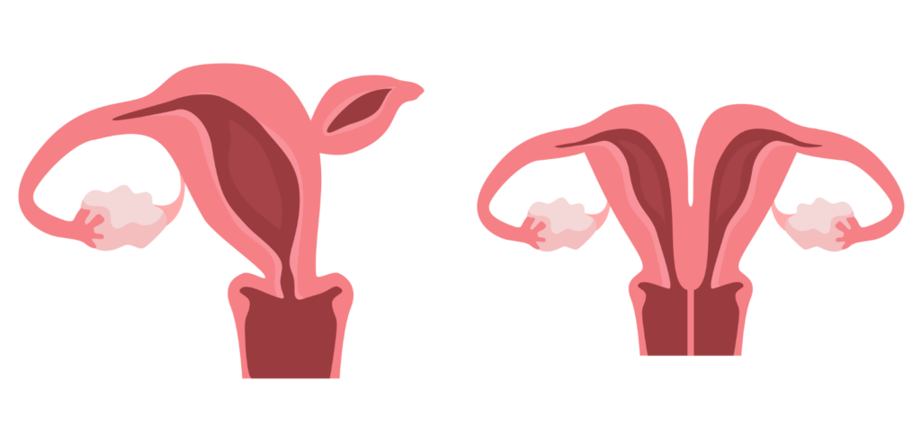 What-is-Vaginismus