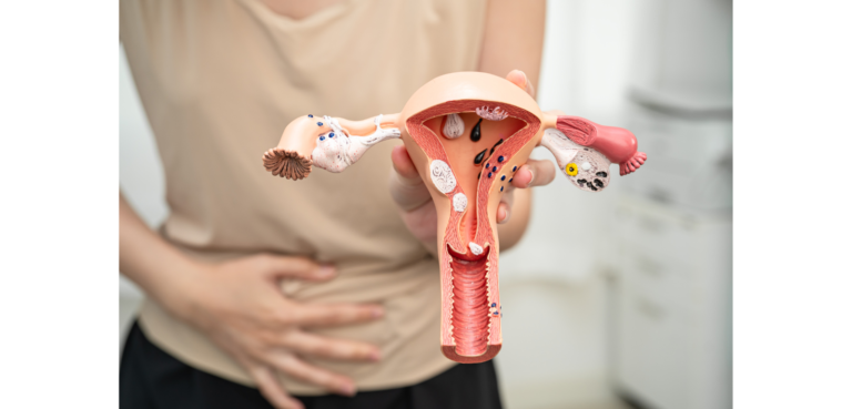 What is Vaginismus: Causes, Symptoms & Treatments
