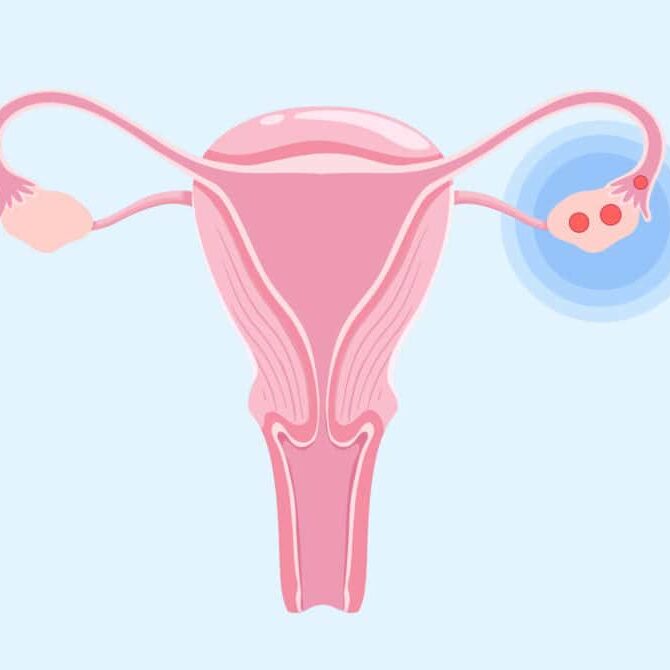 Ovulation Induction